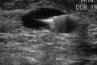FNA image 2