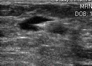 FNA image 3