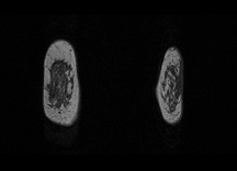 MRI 1