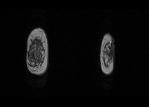 MRI 2