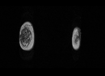 MRI 3